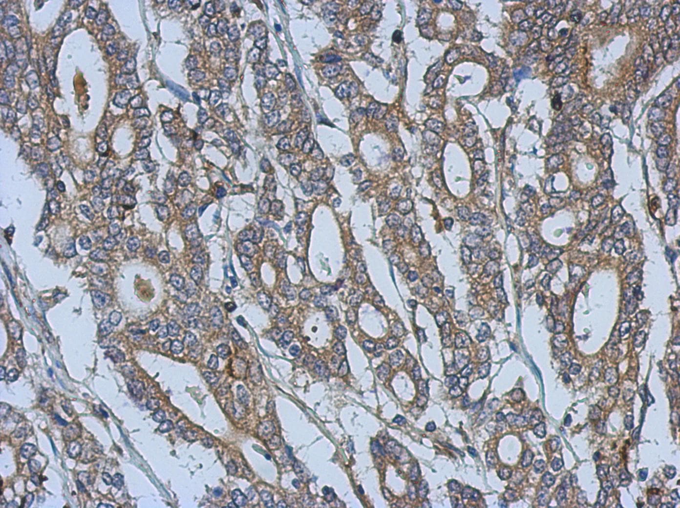 URP2 / FERMT3 Antibody