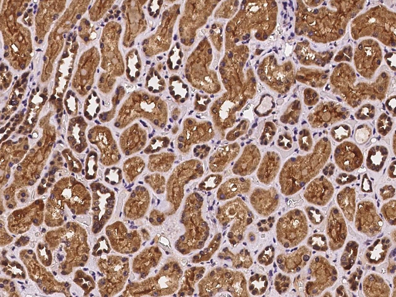 Polyclonal Rabbit anti-Human PEX19 Antibody (IHC, IF)