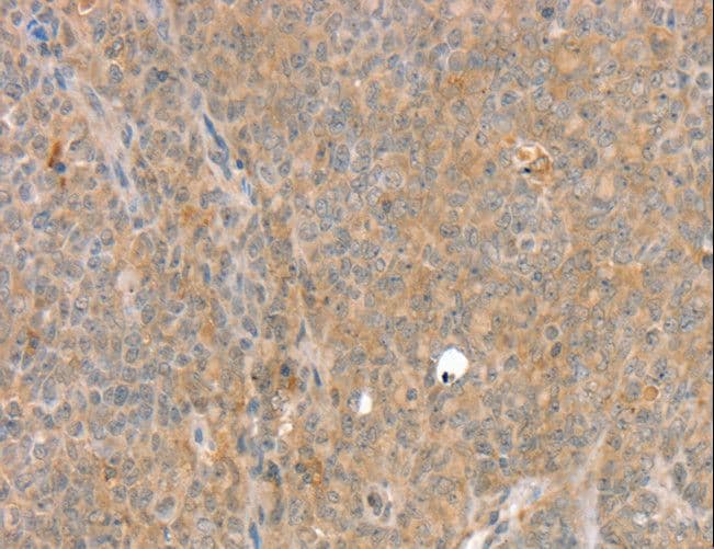 IHC-plus™ Polyclonal Rabbit anti-Human SLC8A3 / NCX3 Antibody (IHC)