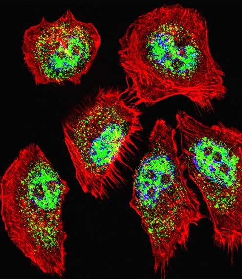 ZHX2 / RAF Antibody (aa105-131)
