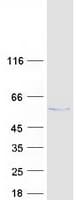Human CTU2 Protein (Recombinant Myc-DDK (Flag))