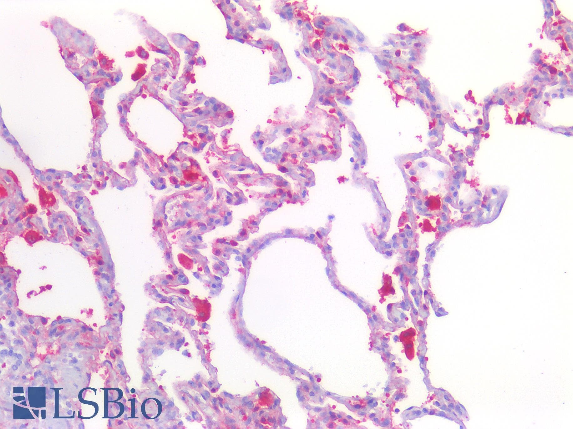 PathPlus™ STK11 / LKB1 Antibody (clone 27D10)