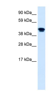 NR1H4 / FXR Antibody (aa194-243)