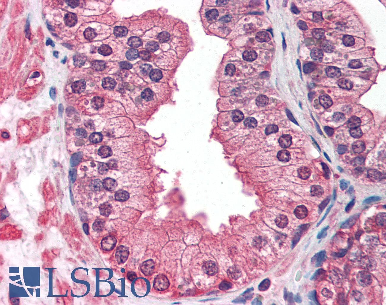 IHC-plus™ IGF1R / IGF1 Receptor Antibody (clone 1H7)