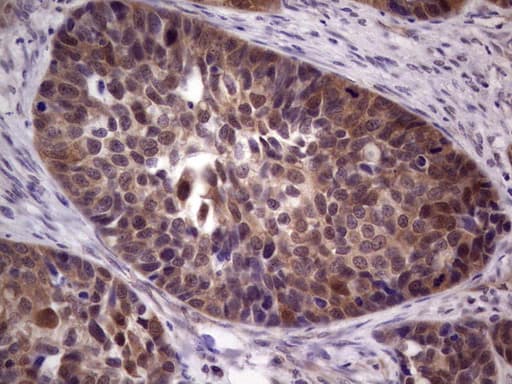 Monoclonal Mouse anti-Human TACC1 Antibody (clone OTI1H2, IHC, WB)
