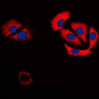 CA6 / Carbonic Anhydrase 6 Antibody (C-Terminus)