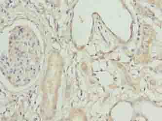 ACSBG1 / hsBG Antibody