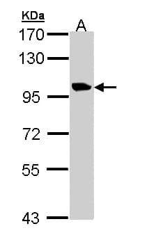 TMEM67 Antibody (aa231-510)
