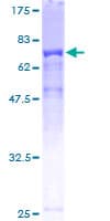 Human TTC38 Protein (Recombinant GST)