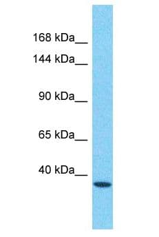 FMNL3 Antibody (aa283-332)