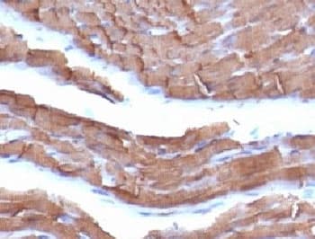 Muscle Actin Antibody (clone MSA/953)