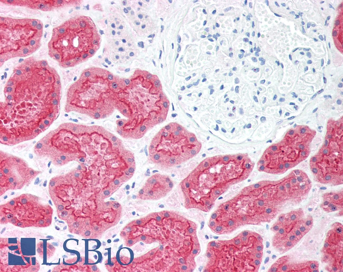 PathPlus™ VIL1 / Villin Antibody