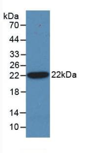 SHH / Sonic Hedgehog Antibody