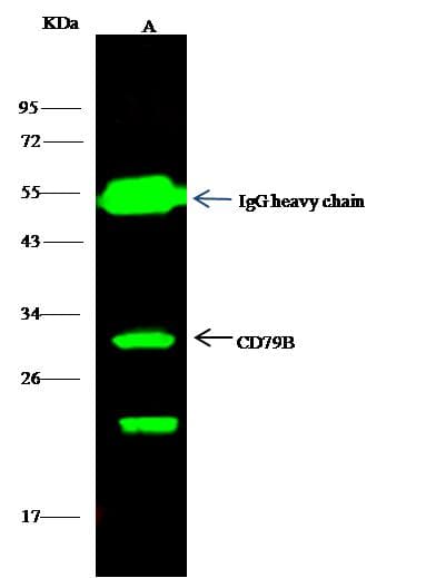 CD79B / CD79 Beta Antibody (Preservative Free)