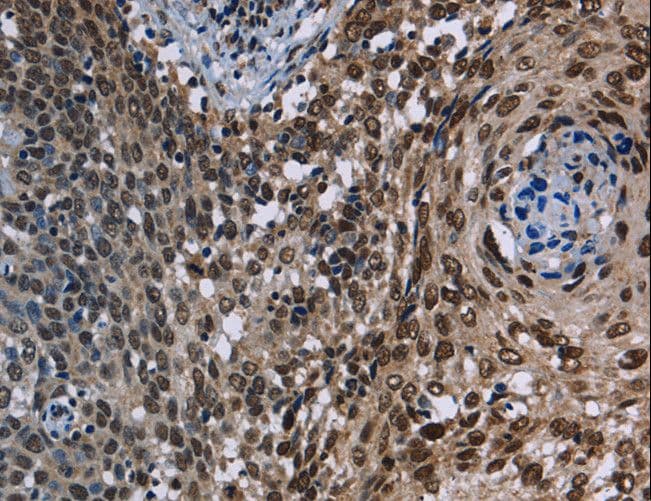 Polyclonal Rabbit anti-Human KDM3B / JMJD1B Antibody (IHC, WB)