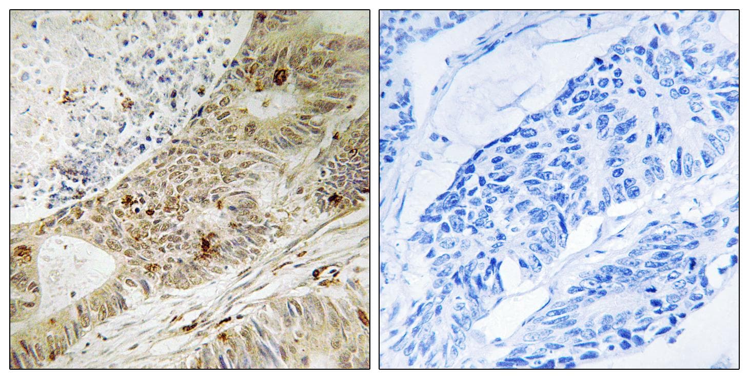 ATRIP Antibody (phospho-Ser224)