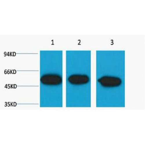 Monoclonal Mouse anti-Human TUBB3 / Tubulin Beta 3 Antibody (clone Mix, WB)