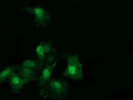 RAB30 Antibody (clone OTI1B2)