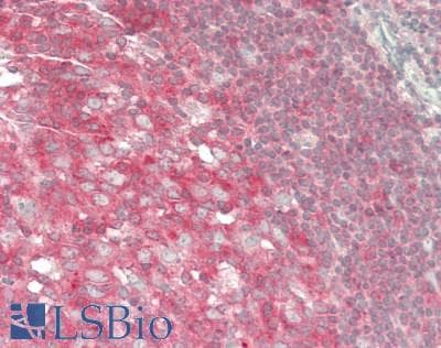 IHC-plus™ PKN1 Antibody