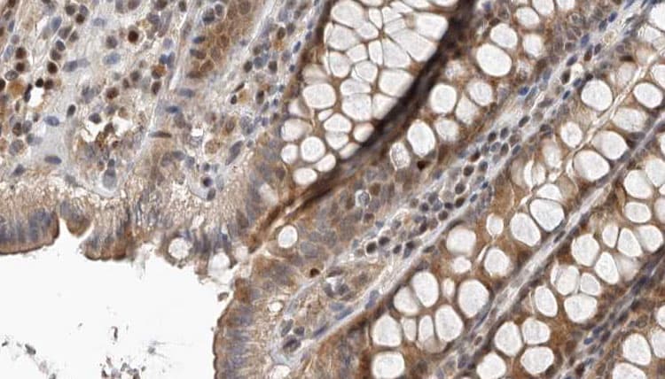 Polyclonal Rabbit anti-Human IDO1 / IDO Antibody (IHC, IF, WB)