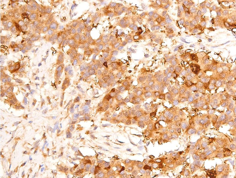 TP53 / p53 Antibody (phospho-Ser15)