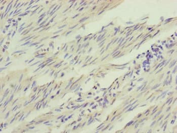 IL1F9 Antibody