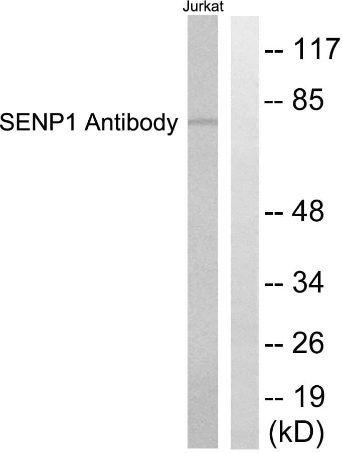 IHC-plus™ SENP1 Antibody (aa1-50)