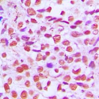 RELA / NFKB p65 Antibody (Internal)