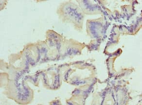 SLC25A20 / CACT Antibody
