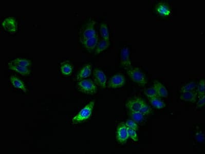 Polyclonal Rabbit anti-Human SLC25A33 Antibody (IHC)