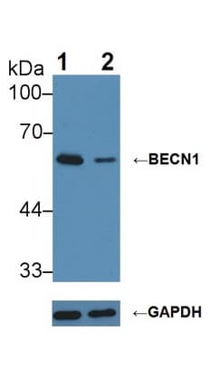 BECN1 / Beclin-1 Antibody (aa1-273)