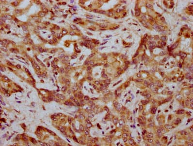 Polyclonal Rabbit anti-Human FAM83G Antibody (IHC)