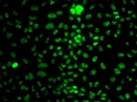 MKI67 / Ki67 Antibody