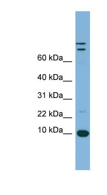 TFF1 / pS2 Antibody (C-Terminus)