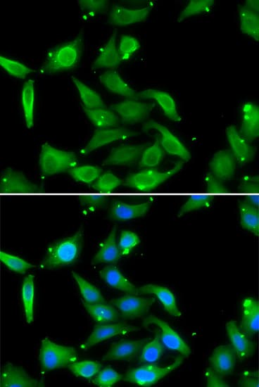 Polyclonal Rabbit anti-Human GAMT Antibody (IHC, IF, WB)