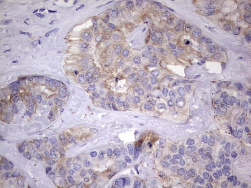 KYNU Antibody (aa1-216, clone OTI5E4)