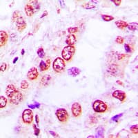 Polyclonal Rabbit anti-Human SKIL / SNO / SnoN Antibody (C-Terminus, IHC, WB)