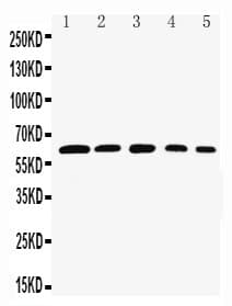 Polyclonal Rabbit anti-Human RELB Antibody (aa393-413, WB)