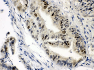 Vitamin D Receptor / VDR Antibody