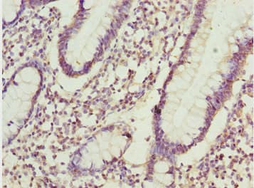 Polyclonal Rabbit anti-Human ADPGK Antibody (IHC, WB)