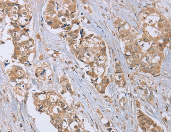 RAB6C Antibody
