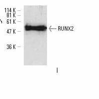 Polyclonal Rabbit anti-Human CBFA1 / RUNX2 Antibody (Asp198, IHC, WB)