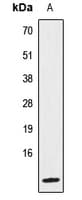 IL8 / Interleukin 8 Antibody (Internal)