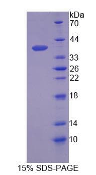 Human SCGB2A2 / Mammaglobin A Protein (Recombinant)