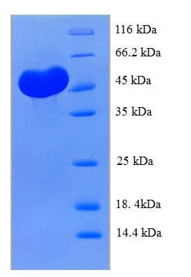 Human CLEC18A Protein (Recombinant His-SUMO)