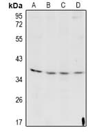Polyclonal Rabbit anti-Human CTSL / Cathepsin L Antibody (WB)