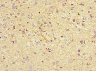 Polyclonal Rabbit anti-Human CHRNA9 Antibody (IHC)