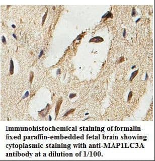 Polyclonal Rabbit anti-Human MAP1LC3A / LC3A Antibody (aa2-121, IHC, WB)