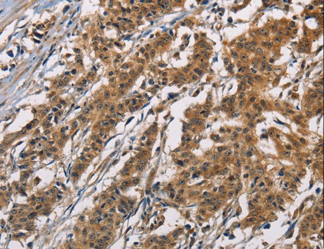 ATP2C1 Antibody
