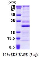 Human RPL26 / Ribosomal Protein L26 (Recombinant His)